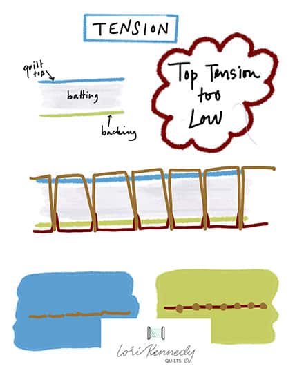 When the Top Tension is Too Low infographic