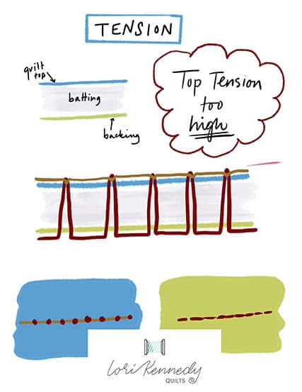 When the Top Tension is Too High infographic